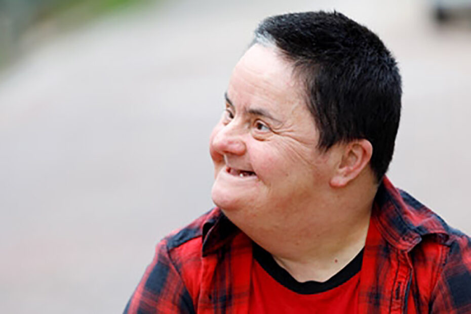 Alzheimers-disease-down-syndrome-male